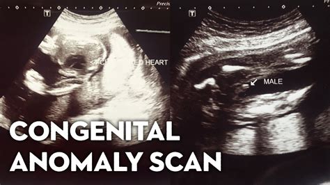 congenital anomaly scan hi precision|Diagnostic Center and Laboratory Clinic .